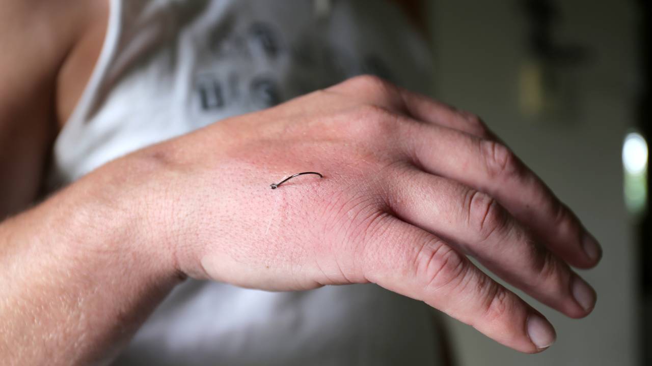 Help! What To Do if You Hook Yourself While Fishing